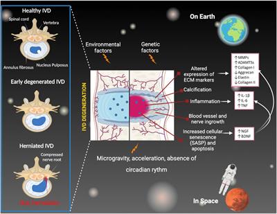 Microgravity and the intervertebral disc: The impact of space conditions on the biomechanics of the spine